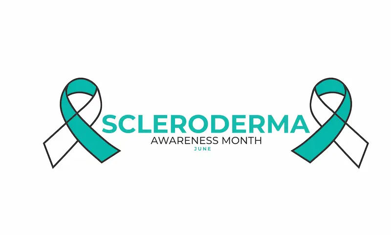 Scleroderma Overview Symptoms, Causes, and Treatment